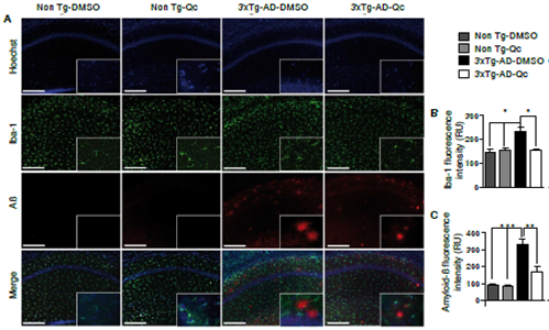 Quercetin Ameliorates Inflammation In Ca Hippocampal Region In Aged