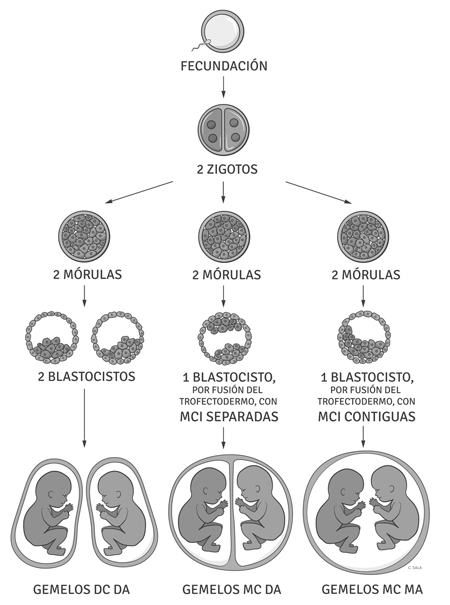 Retirarse Enchufe Traición Tipos De Gemelos Pareja Podar Incompetencia